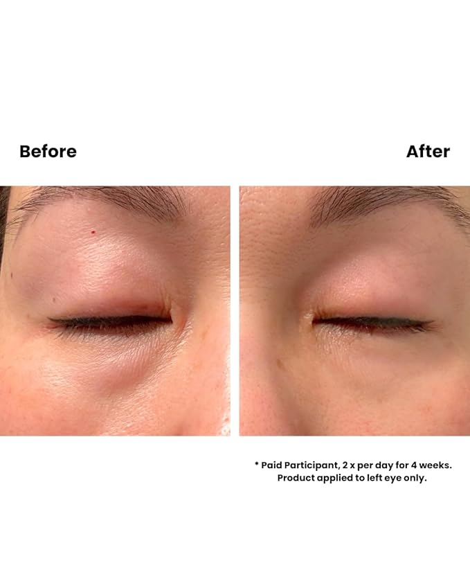 Céla Northern Eye Cream | Reduces Fine Lines, Puffiness & Dark Circles | 30 ml Hydrating & Anti‑Aging Eye Moisturizer with Red Maple Bark Extract & Antioxidants – Gentle for All Skin Types