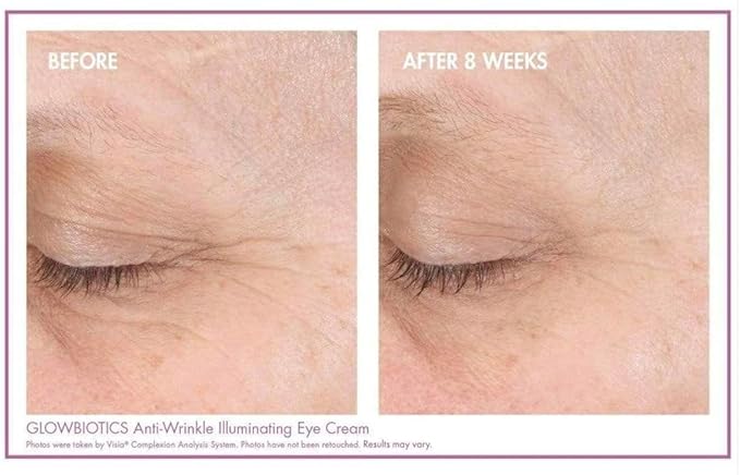 Glowbiotics Anti-Wrinkle Illuminating Eye Cream: Reduces Dark Circles, Puffy Eyes, Fine Lines & Wrinkles, With Probiotics & Antioxidants, 0.5 Fl Oz