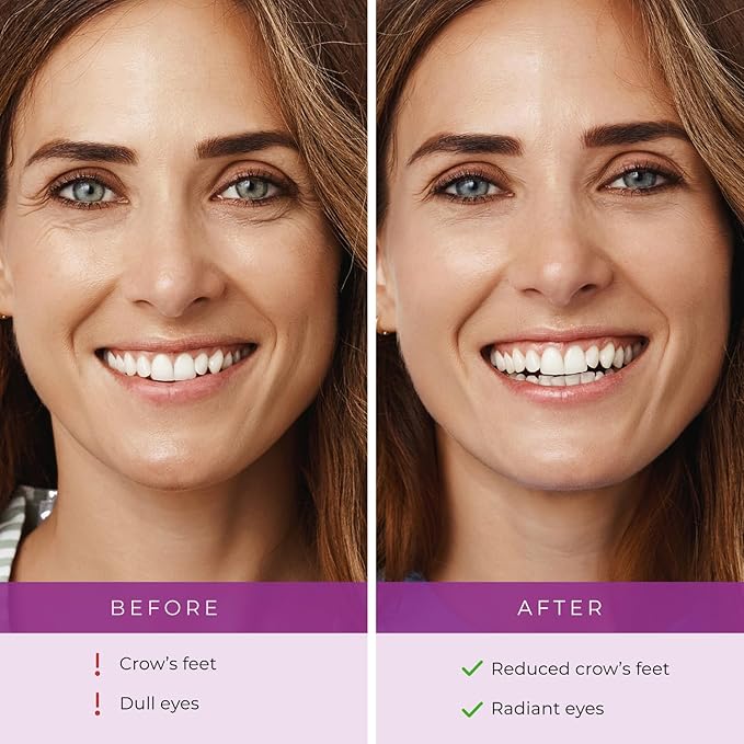 Furlesse Crows Wrinkle Patches, Overnight Eye Patches for Wrinkles and Crow’s Feet Lines, Non-invasive Anti-Wrinkle Patches, Anti-aging Skincare, 60 Patches, 30-Day Use