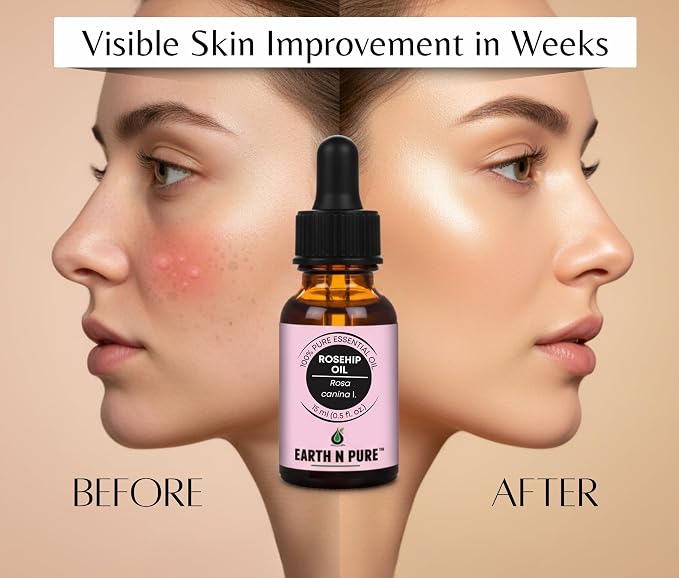 Earth N Pure Rosehip Seed Oil | 100% Pure Natural Cold Pressed Carrier Oil | Premium Quality for Face, Hair, Skin, Nails, Body Massage & DIY Beauty Care | Hexane Free | 30ml