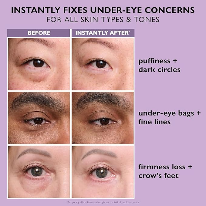 Instant Firm Eye Tightener: Temporary Reduction Serum for under-Eye Bags and Wrinkles
