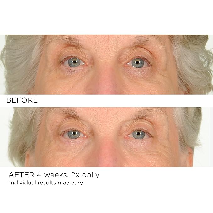NASSIFMD Under Eye Smoother Firming Cream, Anti-Aging Eye Cream for Dark Circles, Puffiness & Wrinkles