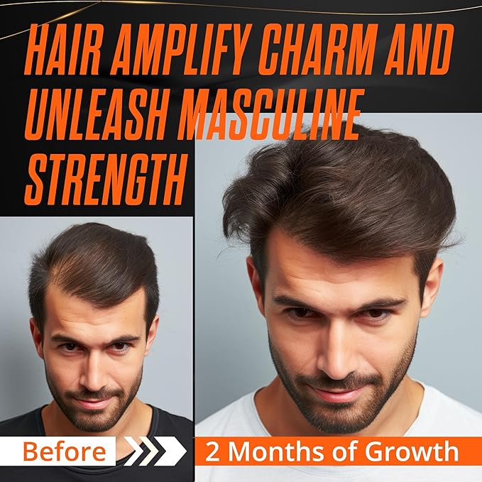 Abera Hair Growth Serum for Hair Loss, Natural Hair Regrowth Treatment for Hair & Beard with Biotin & Castor Oil | Extra Strength & Bigger Size 1.69 fl oz, (2 Serum + Gift)
