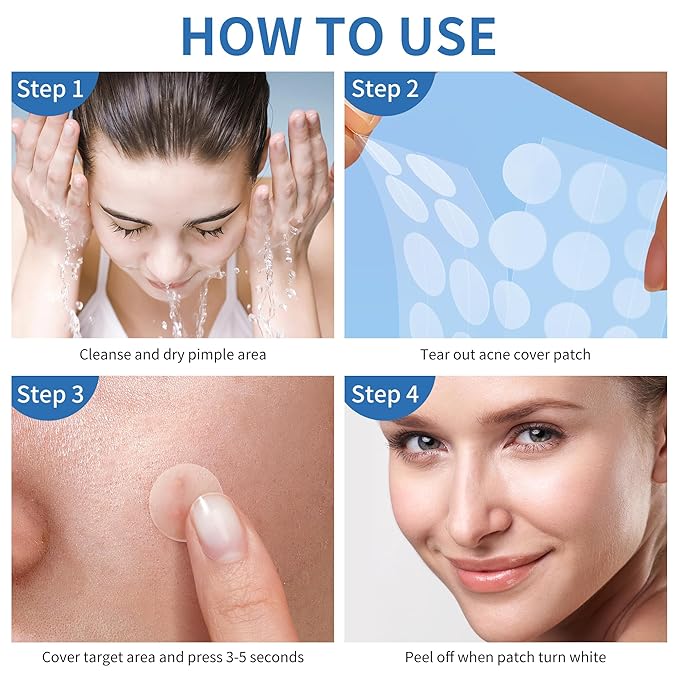 Pimple Patches for Face - 4 Size 700 Counts Acne Patches, Hydrocolloid Patches for Covering Zits and Blemishes, Spot Stickers with Salicylic Acid, Tea Tree Oil & Calendula Oil