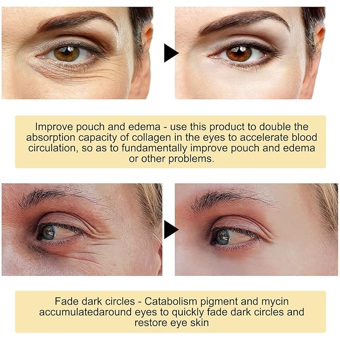 Multi Source PDRN Eye Patches, 5 PDRN Collagen Vitalizing Hydrogel Eye Patch, Eyes Patches For Puffy Eyes And Dark Circles (180pcs)