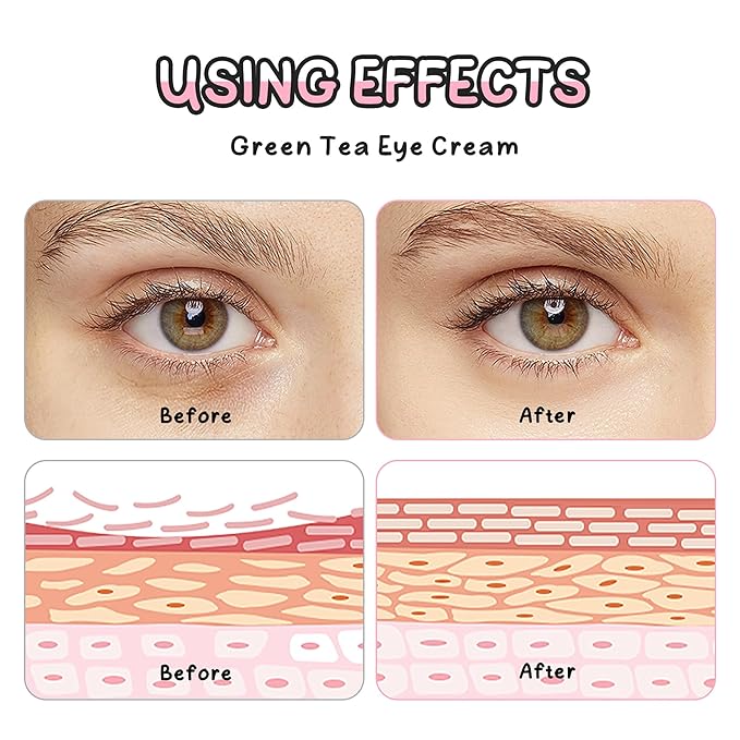 Green Tea Triple-roller Eye Cream, Multi-Effect Under Eye Cream for Smooth Wrinkle & Tighten Skin, Day & Night Moisturizing Eye Cream with Green Tea Extract, Reduce Wrinkles Fine Lines & Bags