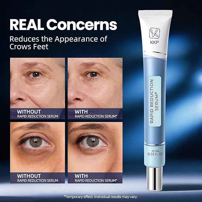 KKP Rapid Reduction Eye Serum - Visibly Reduces Under-Eye Bags, Wrinkles, Dark Circles, Fine Lines & Crow's Feet Instantly, Anti Aging Wrinkle Remover for Face, 3 Full Size Tubes