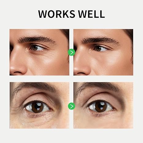 Mens Eye Cream, Eye Bags Treatment for Men, Caffeine Eye Roller for Puffy Eyes and Puffiness, Under Eye Cream for Dark Circles and Wrinkles