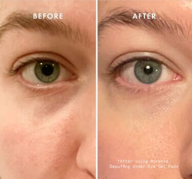 Beauty Pie Depuffing Under-Eye Gel Pads To Tackle Dark Circles & Puffiness