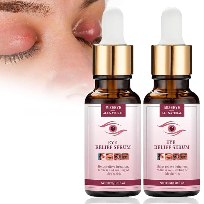 Styes Eye Relief Serum, 2PCS Moisturize Blepharitis & Chalazion Remover, Gentle Under Eyelid Serum For Dark Circles, Puffiness.