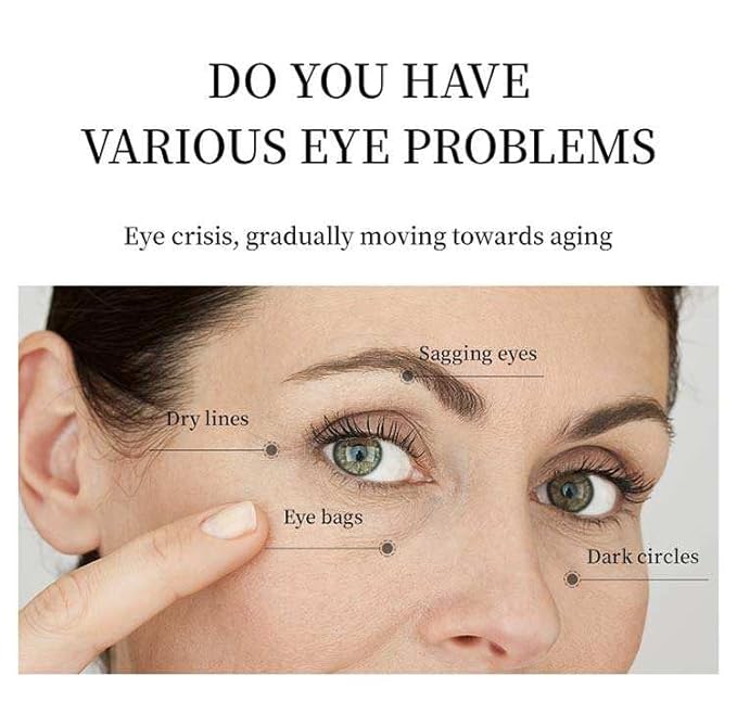 Under Eye Patches for Dark Circles & Puffiness – Hydrating Hydrogel Eye Patches with Niacinamide & Hyaluronic Acid, Cooling Undereye Eye Pads, 60 PCS (30 Pairs), Blue