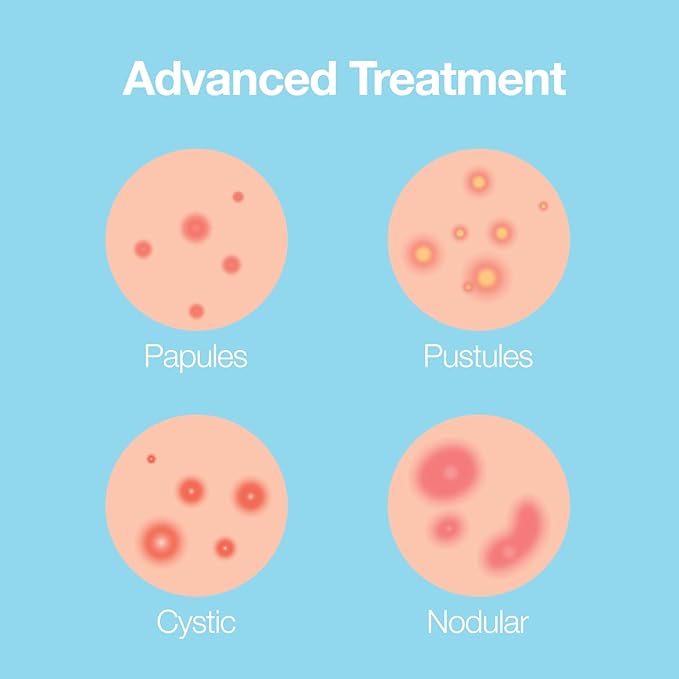 Saplaya K-Beauty Ance Care Hydrocolloid Patches For Acne Pimple Care 100% Hydrocolloid Acne Spot Healing Patch