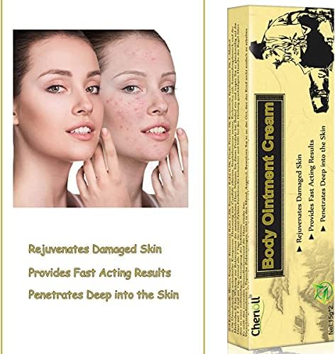 Moisturising Cream, Body and Face Moisturizer for Dry Skin, Acne Cream, 2PC