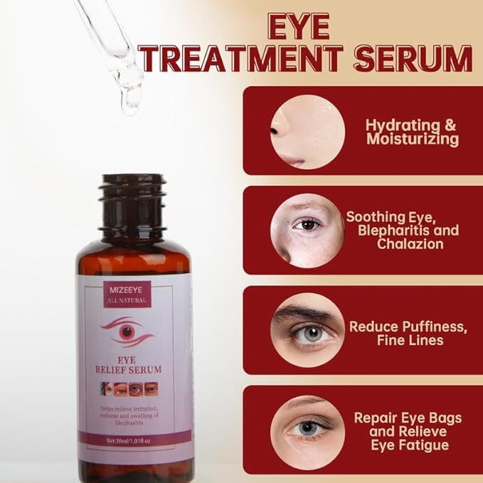 Styes Eye Relief Serum, 2PCS Moisturize Blepharitis & Chalazion Remover, Gentle Under Eyelid Serum For Dark Circles, Puffiness.