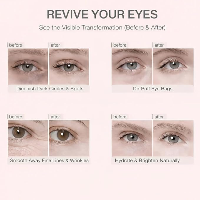 Aurova Beauty Eye Mask, Aurova Collagen Full Eye Masks, 360 Full Coverage Eye Patches with Collagen & Vitamin C, Nourishing and Non Irritating, For Puffy Eyes and Dark Circles, 5 Pairs