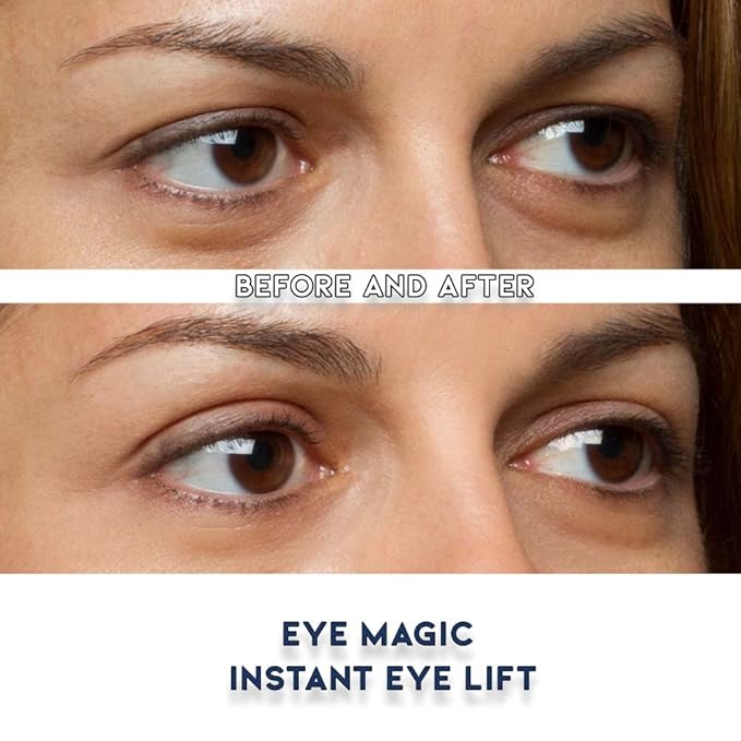Eye Magic Premium Eye Lift Strips - Medium Size, 80 Count Refill Pack, Strips Only (no Gel), for Droopy, Sagging, or Hooded Eyelids, Hypoallergenic, Strong Hold, Made in USA