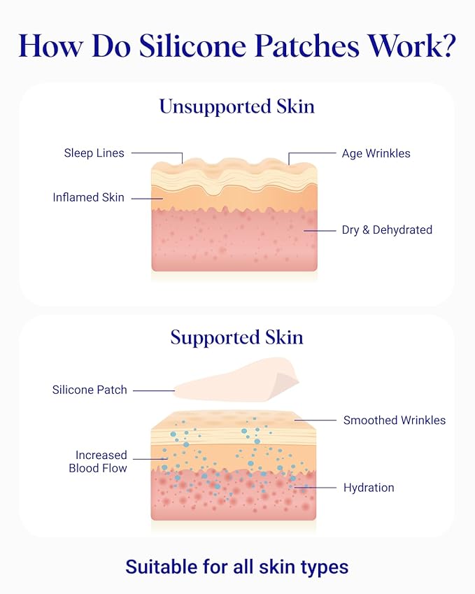 Wrinkles Schminkles Facial Smoothing Set | Mouth & Lip 2-Pack | Eye Wrinkle Patches 3-Pairs | Forehead Wrinkle Patches 2-Pack | Reusable Hypoallergenic Silicone Smoothing Pads