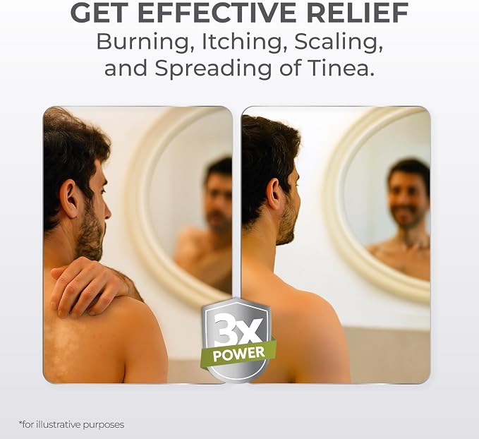 terrasil Tinea Versicolor Treatment Cream Max Strength, Antifungal Tinea Cream, Clinically Proven 1% Clotrimazole, Helps with Most Ringworm & Fungal Infections, Soothing Relief of Itchy Dry Skin (1oz)