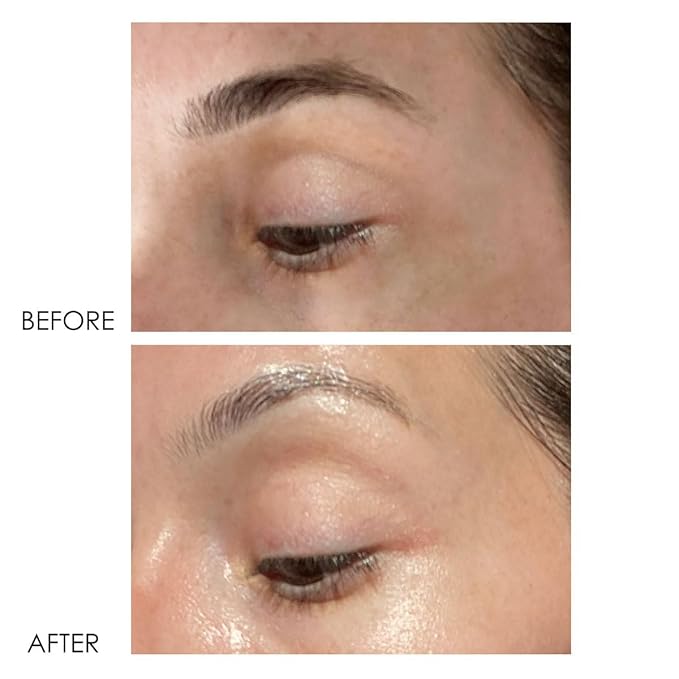 Dermelect Revitalite Eyelid & Dark Circle Corrector- Professional Strength, Anti-Aging Eye Cream with Peptides, Brightening & Tightening Ingredients- Dark Circles, Puffiness, Droopy Eyelids & Wrinkles