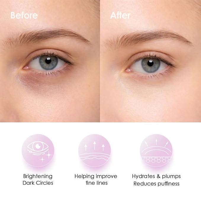 Sweet Dreams Collagen Glow Rose Gold Eye Masks - Korean Under Eye Patches Puffy Eyes, Dark Circles & Wrinkles | Collagen, Niacinamide, Hyaluronic Acid & Peptides | Hydrating Eye Treatment & BeautyCare