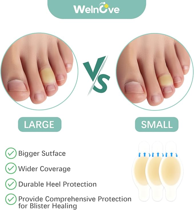 Gel Blister Bandages Hydrocolloid Bandages - Welnove 30ct Blister Cushions (Toe Pack) - Blister Bandages for Heel, Toe & Foot - Blister Pads for Prevention & Recovery - Water Resistant Bandages