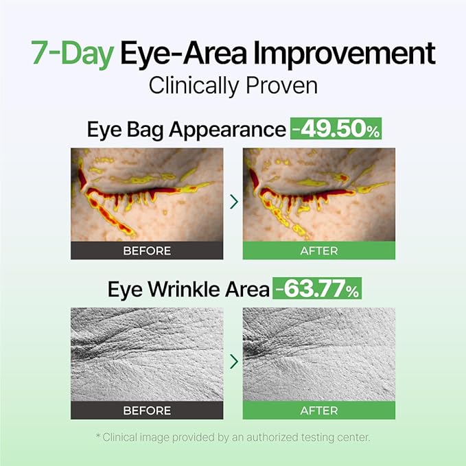 IZEZE Exosome PDRN Firming Eye Cream | Pdrn Eye Cream, Eye Firming Cream, Korean Eye Cream for Dark Circles, Wrinkle Treatment, Firming, Lifting, Under Eye Bags, Nasolabial Fold and Neck, 1.01 fl.oz
