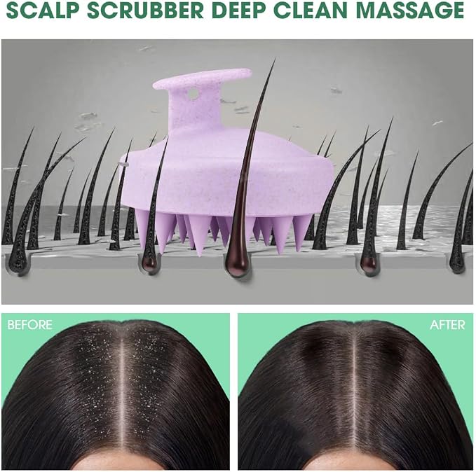 Scalp Massager Brush for Hair Growth – Silicone Scalp Scrubber & Scalp Exfoliator – Manual Scalp Massager Brush for Wet or Dry Use – Hair Massager Scalp Shampoo Brush Tool (Purple)