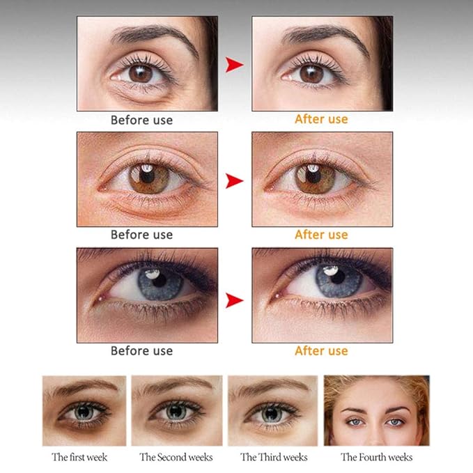 Eye Peptide Serum Massage Roller Nourishing Relieve Loose Eye Bags Dark Circles Skin Care Under Eye Cream for Fine Wrinkles and Puffiness Daily Skincare(Nourishing Grey)
