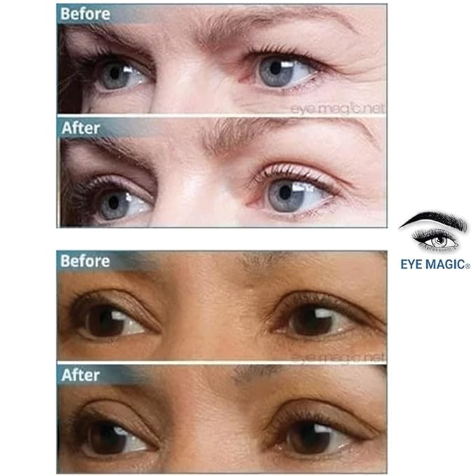 Eye Magic Premium Original Eye Lift Kit - Medium-Kit Size, 64 Count, Strips + Wax/Gel, Original Premium Kit, Made in USA