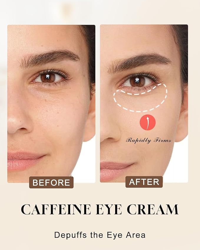 TJE Caffeine Eye Cream, Under Eyes Cream with Hyaluronic Acid & Vitamin E, Under eye Treatment Serum for Women & Men - 15 g