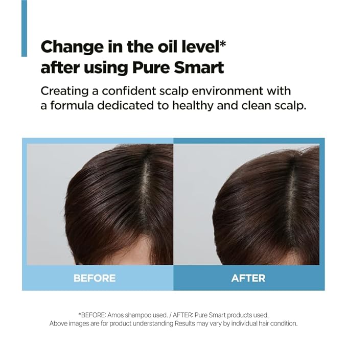 AMOS PROFESSIONAL Pure Smart Peeling l Scalp Treatment for Oily & Flaky Scalp l Deep Cleansing, Scalp Exfoliator l 0.67 fl. oz. X 4ea