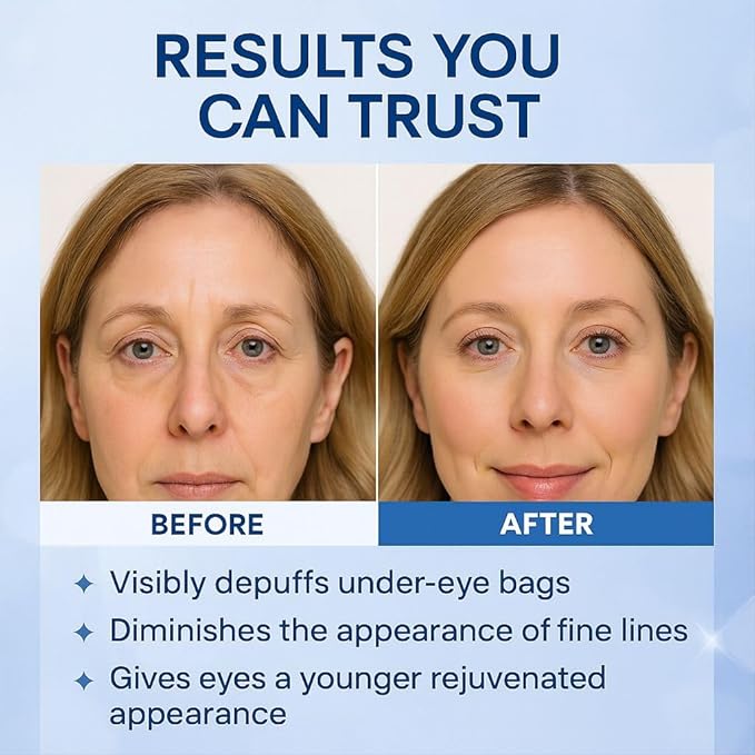 Instant Under Eye Lift Serum – Fast-Acting Firming Formula to Reduce Eye Bags, Wrinkles, Puffiness & Dark Circles | Advanced Polysaccharide Technology for Mature Skin – 20 mL (Fragrance Free)