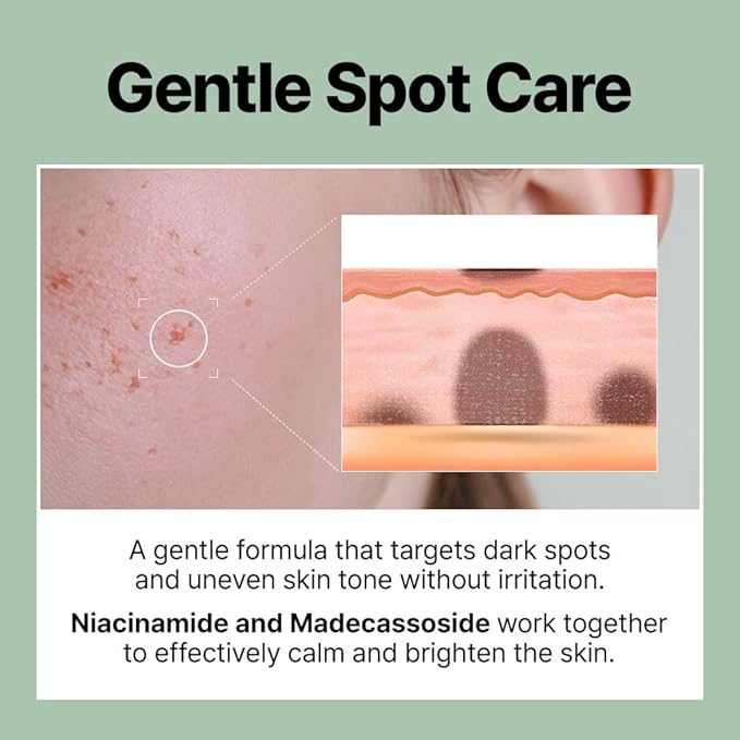 FRANZ Dark Spot Pimple Patches for Acne Marks & Post Acne Spots, Invisible Thin Pimple Spot Treatment, Makeup-Friendly with UV Protection – 72 Patches (Value Pack)