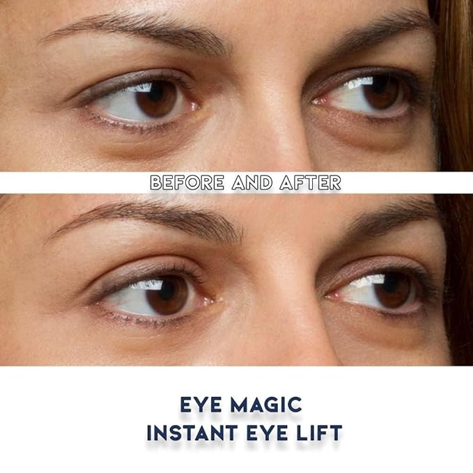 Eye Magic Premium Eye Lift Strips - Small Size, 88 Count Pack, Strips Only (no gel), for Smaller Eyelid Sizes, Instant Non-Surgical Lift, Made in USA