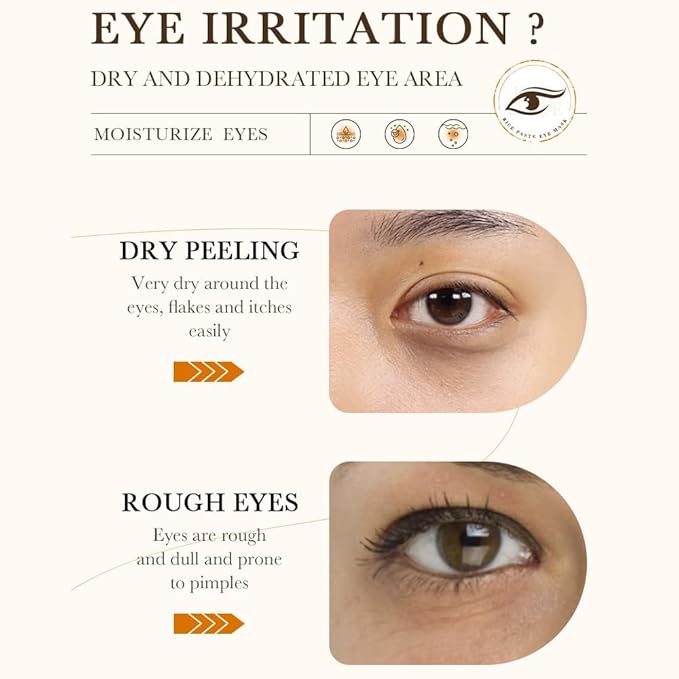 BIOAQUA Rice Raw Pump Eye Mask - 60 Pairs Gel Patches for Dark Circles & Puffiness - Nourishing & Hydrating Under Eye Treatment with Hydrolyzed Rice Extract - 80g / 30 Pairs