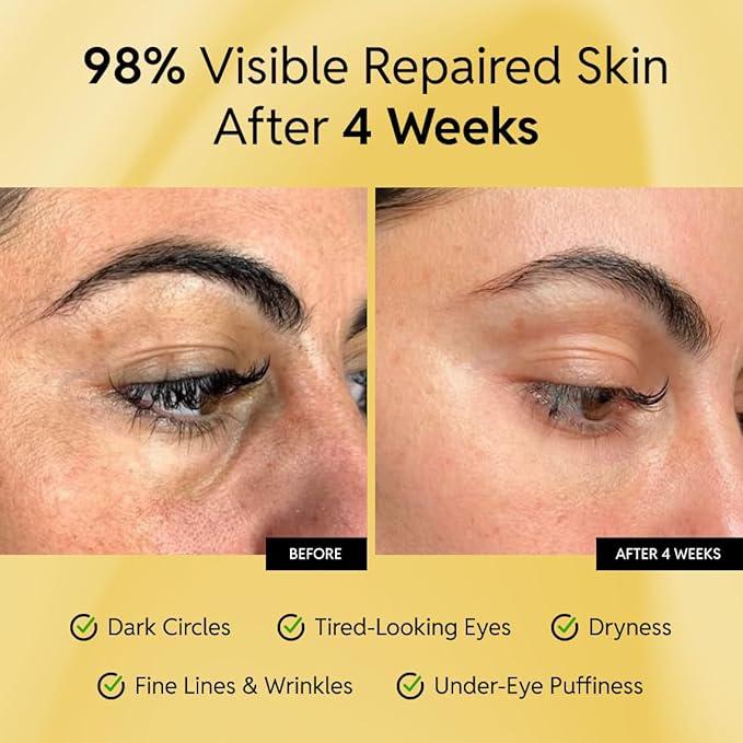 Eliré Repair Eye Cream - Restores and Strengthens Delicate Under-Eye Skin - With Ceramides and Caffeine - Reduces Fine Lines, Wrinkles and Puffiness - Fast-Absorbing - Dermatologist-Tested - 15ml