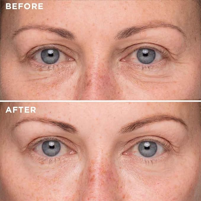 PRAIMY Firming Eye Serum – Anti-Aging Eye Serum for Dark Circles, Puffiness, Fine Lines & Wrinkles with Retinol, Caffeine & Hyaluronic Acid – 1 fl oz