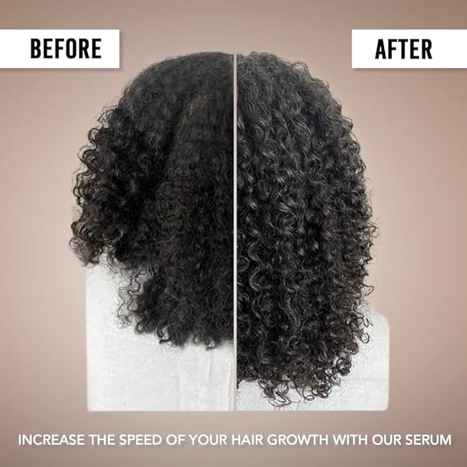 Hair Growth Serum, Hair Treatment For Women 1 FL Oz (30 mL) (Pack Of 3)