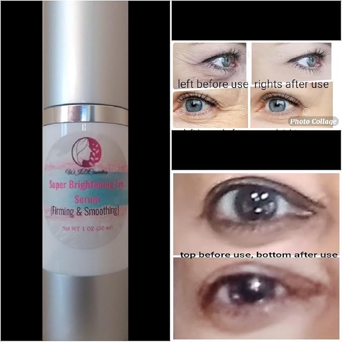Brightnening Eye Serum with Niacinamide (vitamin B3). Powerful Eye Treatment Serum-Advanced Formula, Anti-aging, Visibly Rapid Wrinkle Reduction and Crow feet (30 ml)