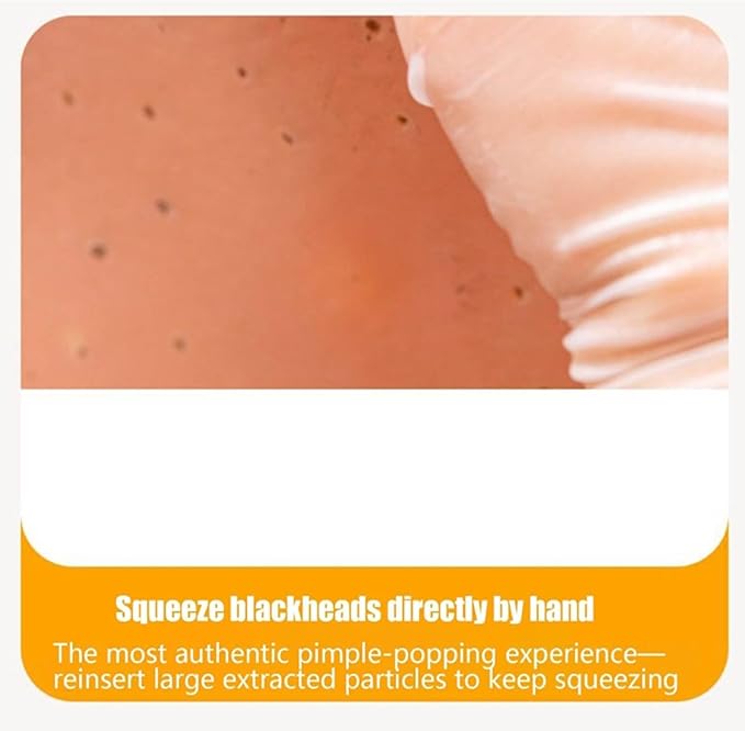 Pimple Popping Toy, Realistic Silicone Face Acne Simulator with Tweezers for Stress Relief, Sensory Fidget Game Gift for Adults and Teens Office Home (Blackheads with Black sebum)