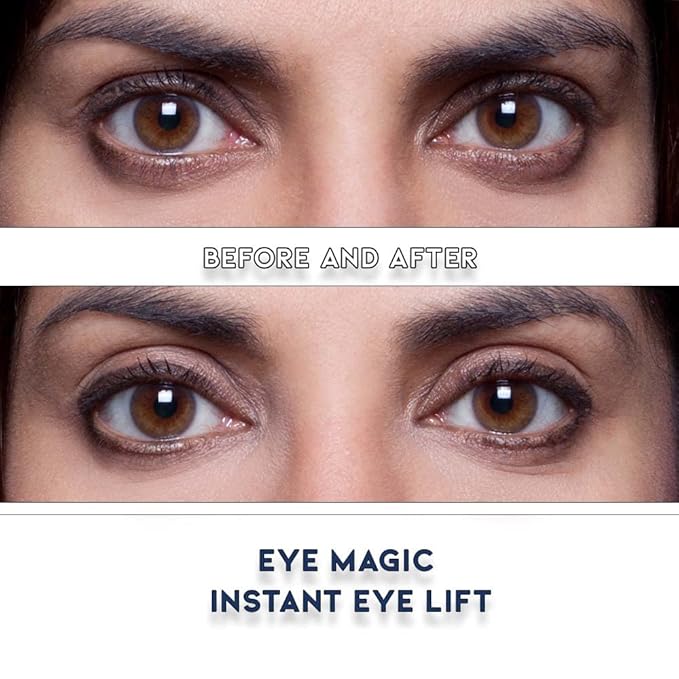 Eye Magic Premium Eye Lift Strips - Medium Size, 80 Count Refill Pack, Strips Only (no Gel), for Droopy, Sagging, or Hooded Eyelids, Hypoallergenic, Strong Hold, Made in USA
