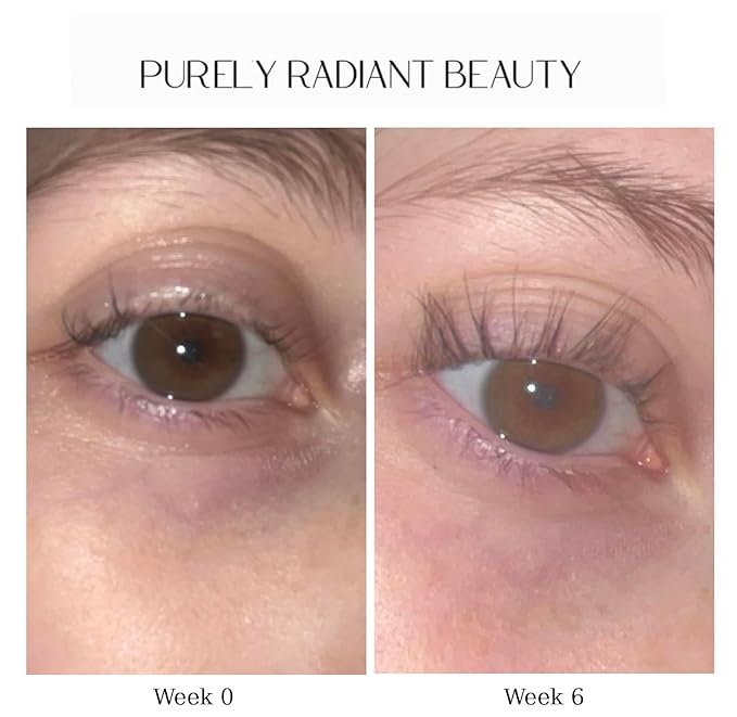 Beauty Eyelash Growth Serum – Prostaglandin-Free Lash & Brow Enhancer for Longer, Thicker Lashes – Vegan, Cruelty-Free, Castor Oil Based – Natural Lash Serum for Growth