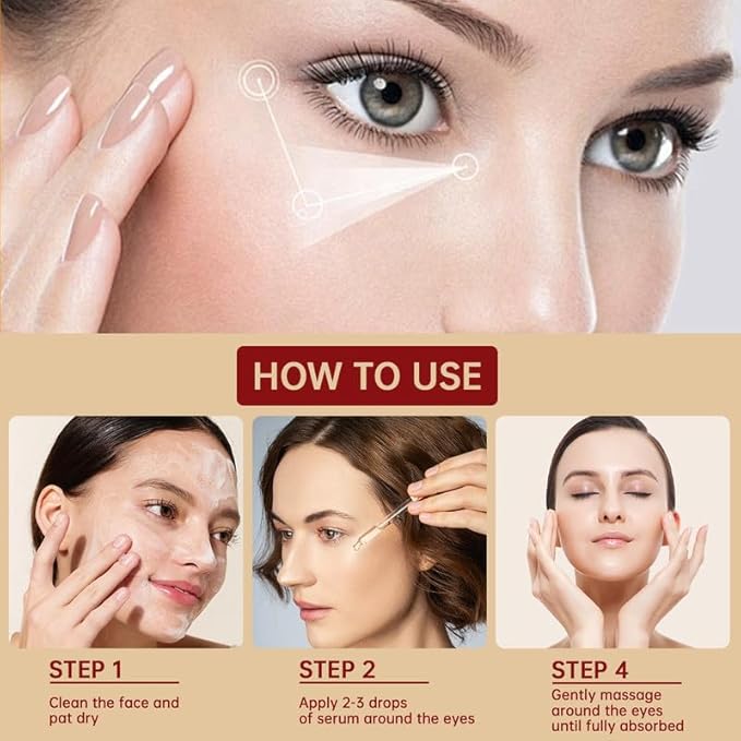 Styes Eye Relief Serum, 30ml Moisturize Blepharitis & Chalazion Remover, Gentle Under Eyelid Serum For Dark Circles, Puffiness.