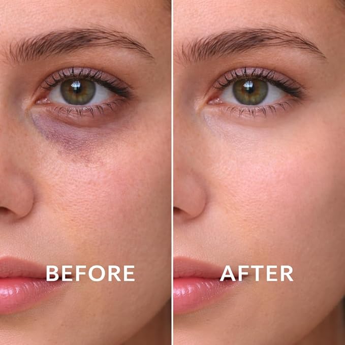 Under Eye Brightener with Cooling Metal Rollerball - Ceramide & Caffeine Eye Serum for Dark Circles and Puffiness Anti Aging, for Men/Women 15ml / 0.51floz (2Pcs) ﻿