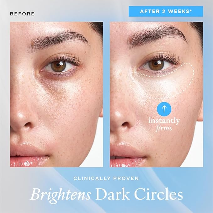 belif Aqua Bomb Cooling Eye Gel - Caffeine & Hyaluronic Acid for Puffiness & Hydration, Niacinamide & Vitamin C for Dark Circles, Adenosine & Collagen for Plumping, Korean Skin Care