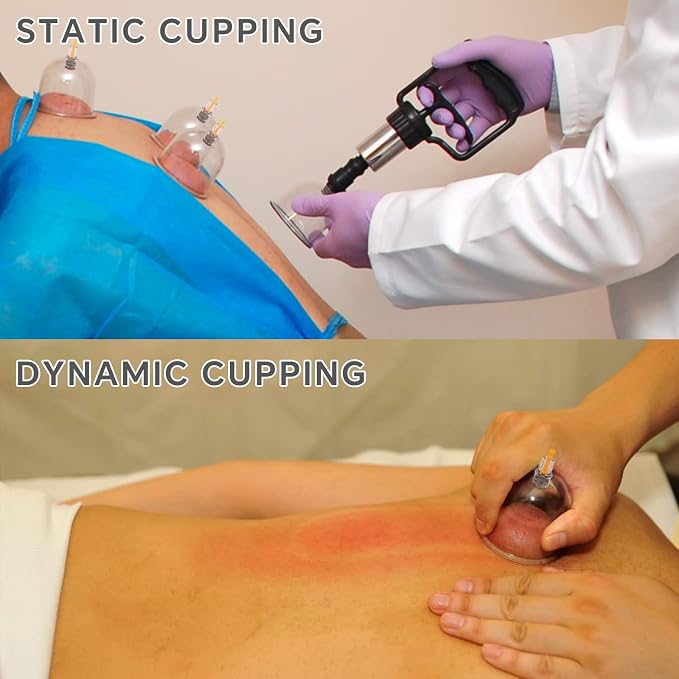 Cupping Kit for Massage Therapy Set with Pump 24 Massage Cups for Cellulite Reduction Muscle Back Pain Relief