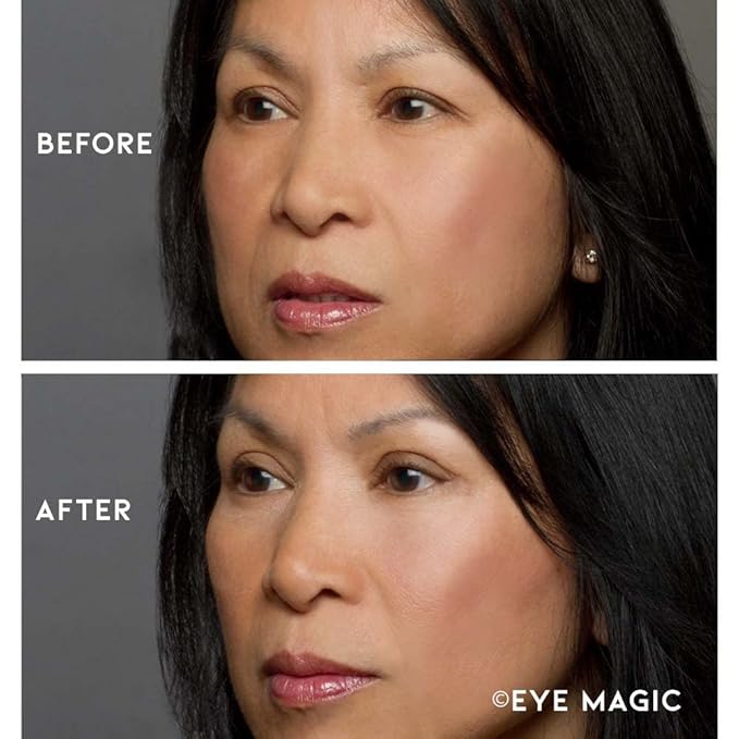 Eye Magic Premium Eye Lift Strips - Medium Size, 80 Count Refill Pack, Strips Only (no Gel), for Droopy, Sagging, or Hooded Eyelids, Hypoallergenic, Strong Hold, Made in USA