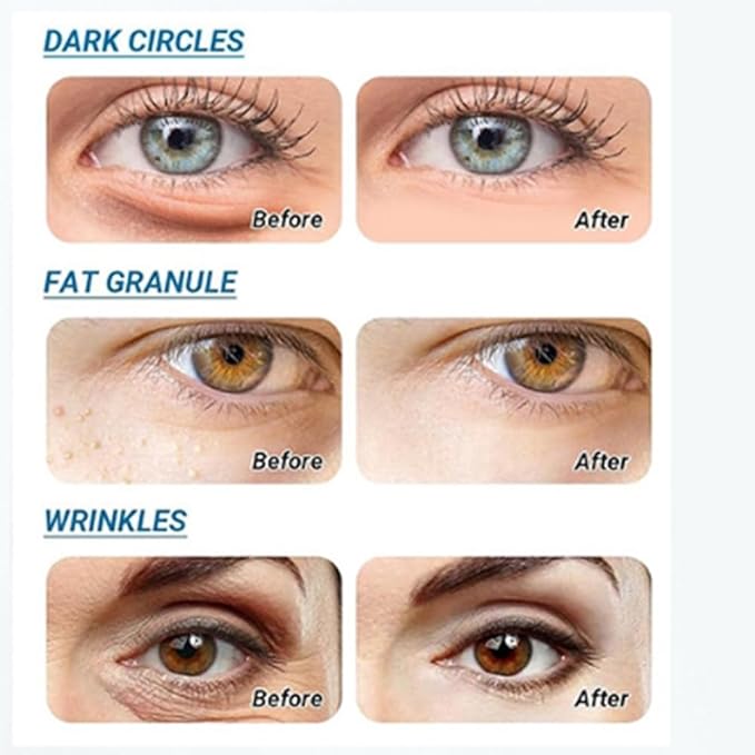 Under Eye Bags and Wrinkles Line Eraser,2Packs Update Instant Eye Cream for Puffiness Removal, Anti Aging Wrinkle Hydrating Smoothing Formula with Moisturizing Fine Lines Treatment for Women and Men