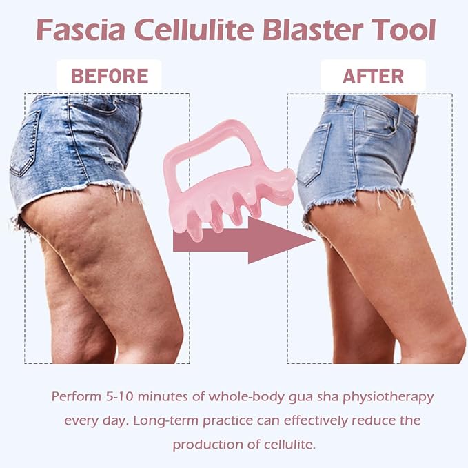 Lymphatic Massager for Cellulite Remover Body Sculpting - Handheld Cellulite Massage Tool for Body Bloat Blood Circulation Lymphatic Drainage Fascia Massage