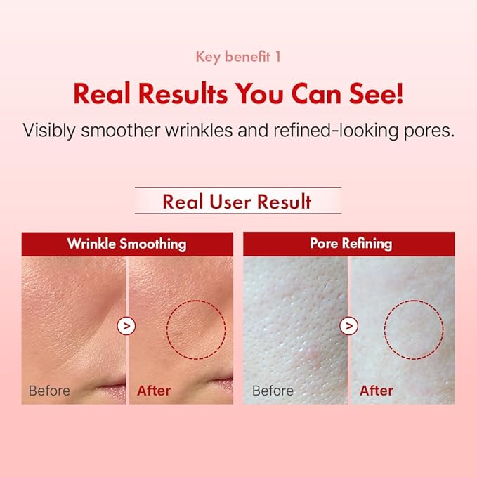 Hanskin Retinol Facial Cream, Repair Fine Lines & Wrinkle, Anti Aging Retinol Moisturizer for Face, For Smoothing Firming Revitalizing Radiant Glow Skin, Korean Skincare, 50ml/1.69 FL Oz